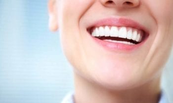 teeth whitening - Smileperfectors