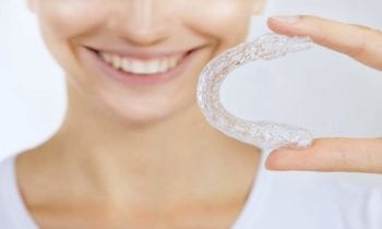 About Invisalign - Smileperfectors