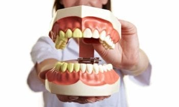 Keep Your Oral Health - Smileperfectors
