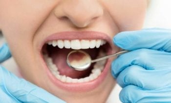 Tooth Enamel - Smileperfectors