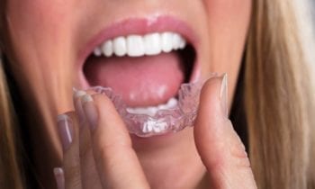 nightguard Teeth Grinding - Smileperfectors