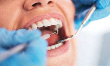 Dental CheckUp-Smileperfectors