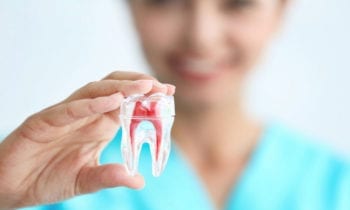 Effective Root Canal Therapy - Smileperfectors