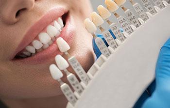 Dental Services, Smile Perfectors