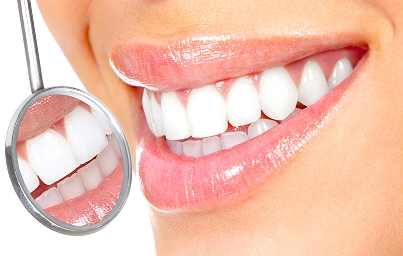 Teeth Whitening Tysons Corner