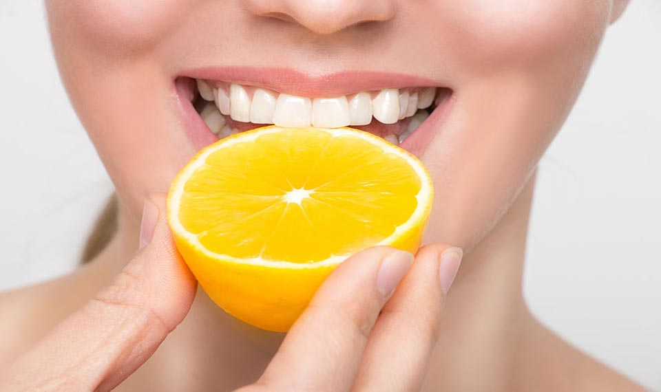 How Vitamin “C” Can Help Gum and Teeth Health? Smile Perfectors