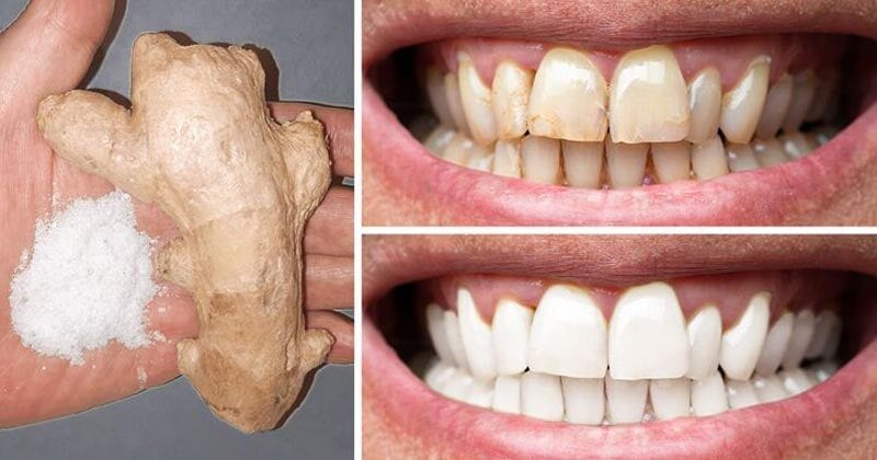 5 Quick and Effective At-Home Teeth Whitening Methods Trying Natural Remedies