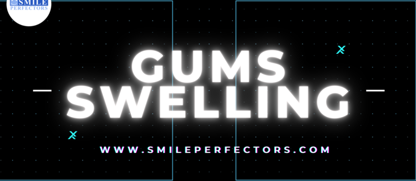 treat swollen gums, Smile Perfectors