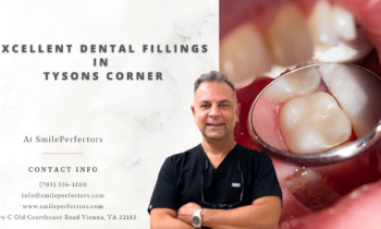 Excellent Dental Fillings Tysons Corner SmilePerfectors