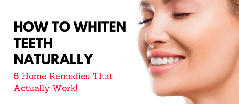 Whiten Teeth Naturally, Smile Perfectors