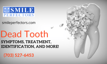 Dead Tooth – Symptoms-Treatment-Identification