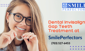 Dental Invisalign Gap Teeth Treatment At SmilePerfectors