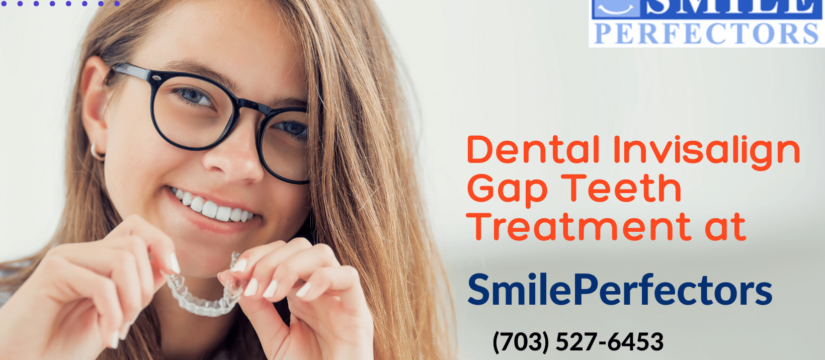 Dental Invisalign Gap Teeth, Smile Perfectors