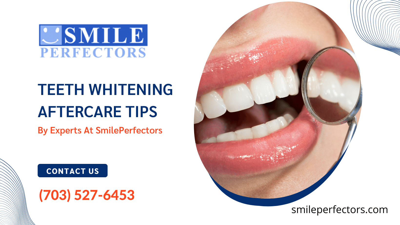 Teeth Whitening Aftercare Tips By Experts At SmilePerfectors.