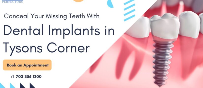 Dental Implants Tysons Corner, Smile Perfectors