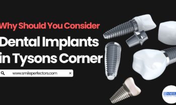 Dental Implants in Tysons Corner