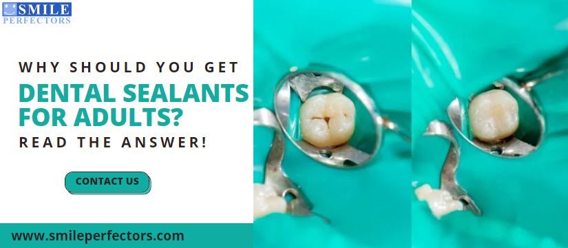 Dental Sealants For Adults, Smile Perfectors