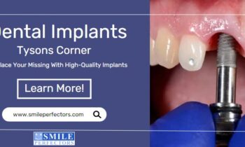 Dental Implants Tysons Corner - SmilePerfectors
