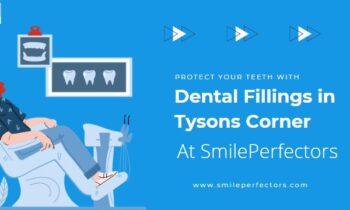 Dental Fillings in Tysons Corner - SmilePerfectors