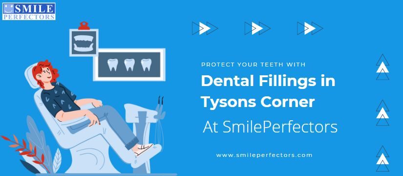 Dental Fillings in Tysons Corner, Smile Perfectors