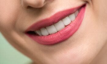 Say Goodbye to Tooth Stains! Smile Perfectors Offers Effective Solutions for a Brighter, Whiter Smile